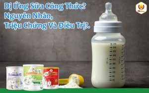 Dị Ứng Sữa Công Thức? Nguyên Nhân, Triệu Chứng Và Điều Trị