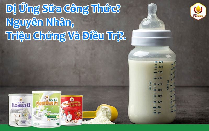 Dị Ứng Sữa Công Thức? Nguyên Nhân, Triệu Chứng Và Điều Trị Dị Ứng Sữa Công Thức? Nguyên Nhân, Triệu Chứng Và Điều Trị