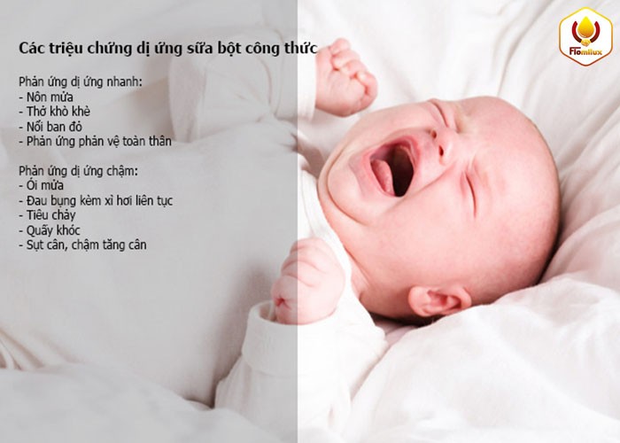 Triệu chứng dị ứng sữa bột công thức ở trẻ sơ sinh và trẻ nhỏ