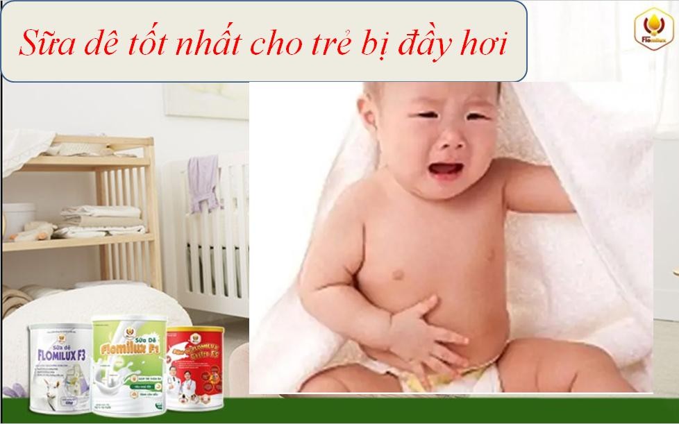 Chướng Bụng