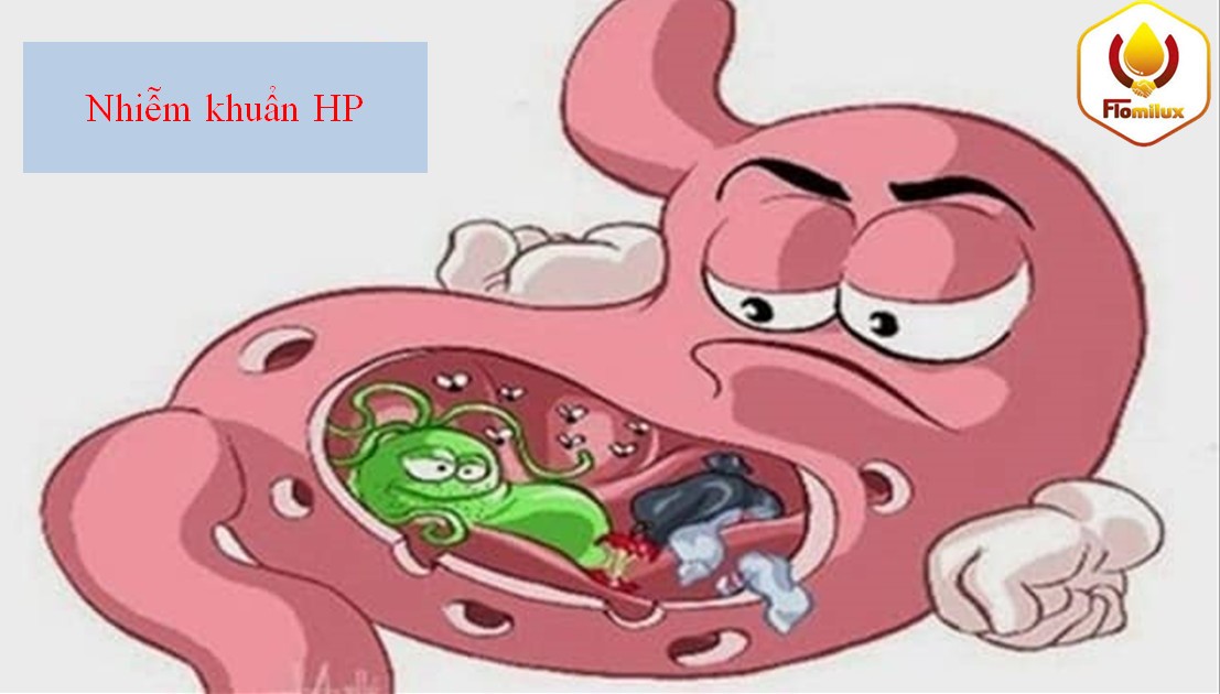 Nhiễm khuẩn HP dạ dày Nhiễm Khuẩn Hp