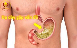Các vấn đề về dạ dày