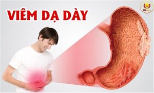 Viem Da Day